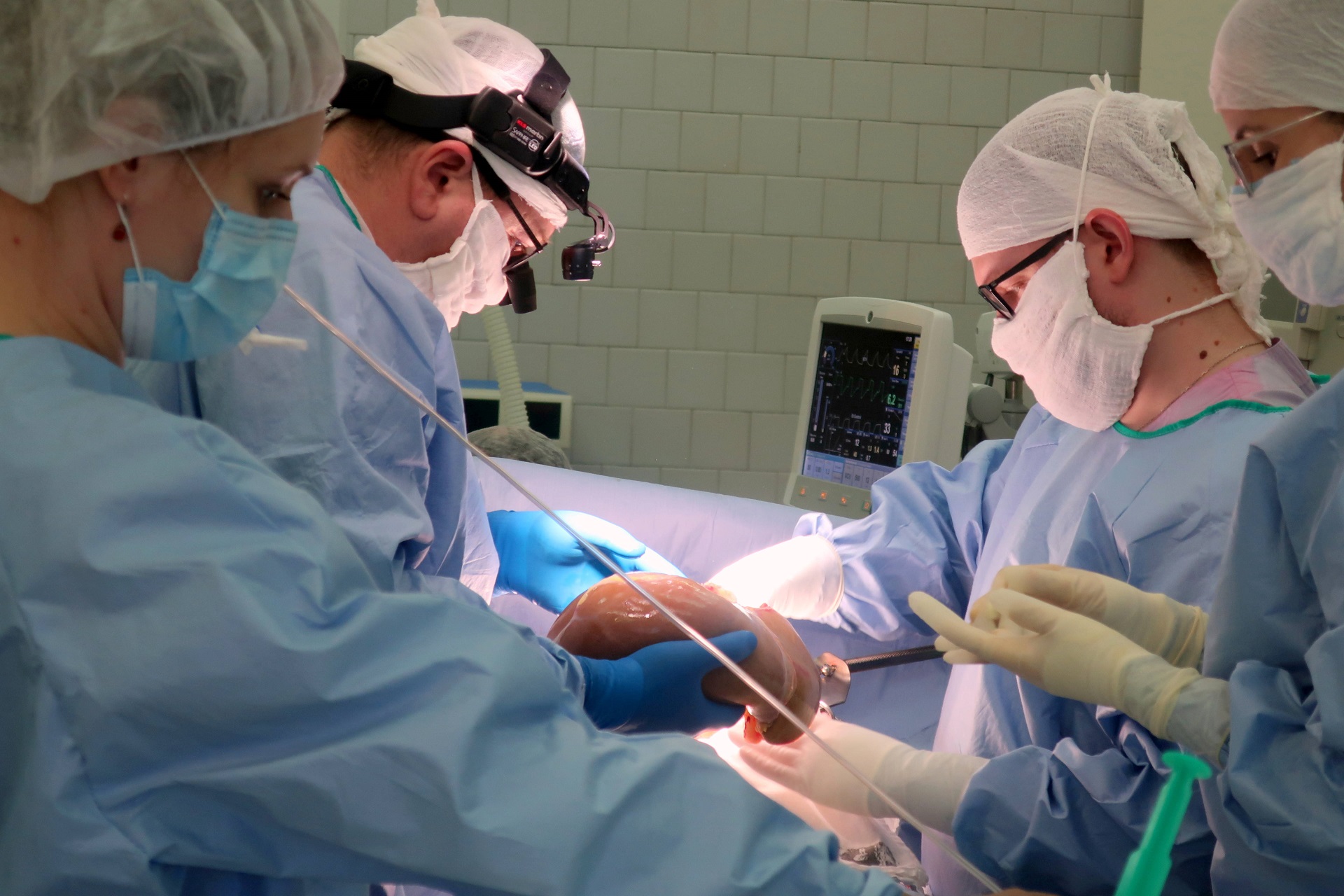 Трансплантация операция
